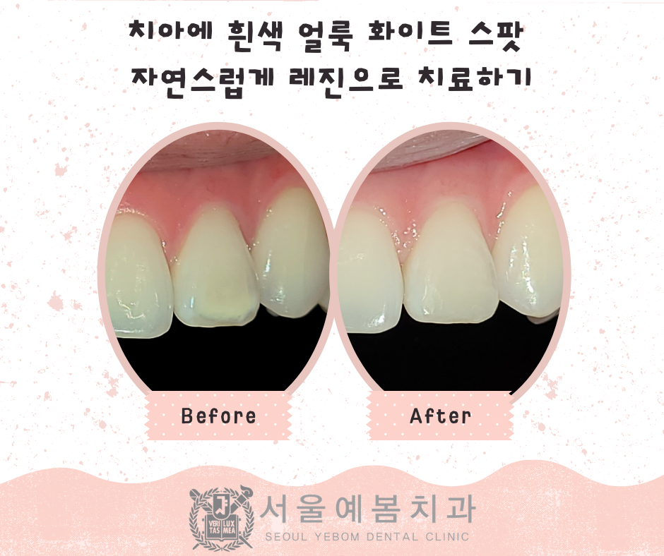 서울예봄치과 이미지