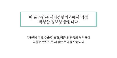 제니성형외과의원 이미지