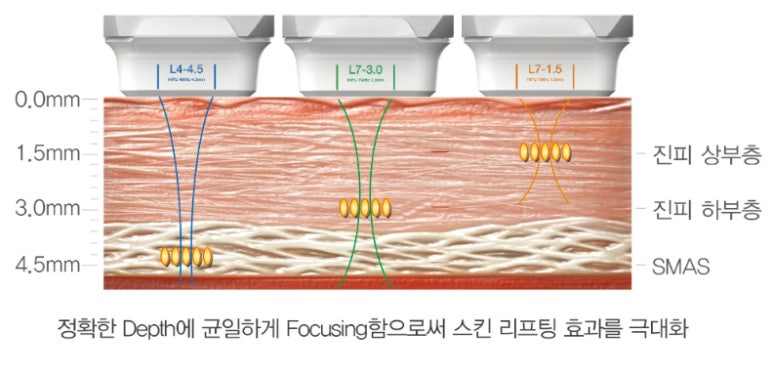 디자인후 이미지