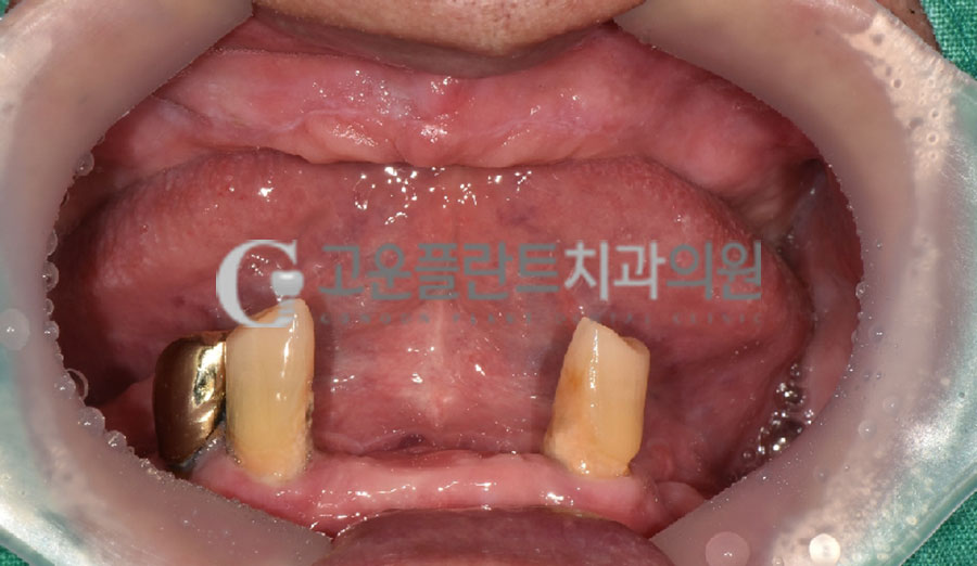 고운플란트치과의원 이미지