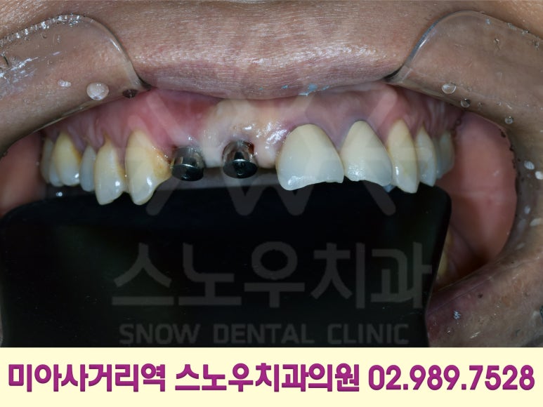 스노우치과의원 이미지
