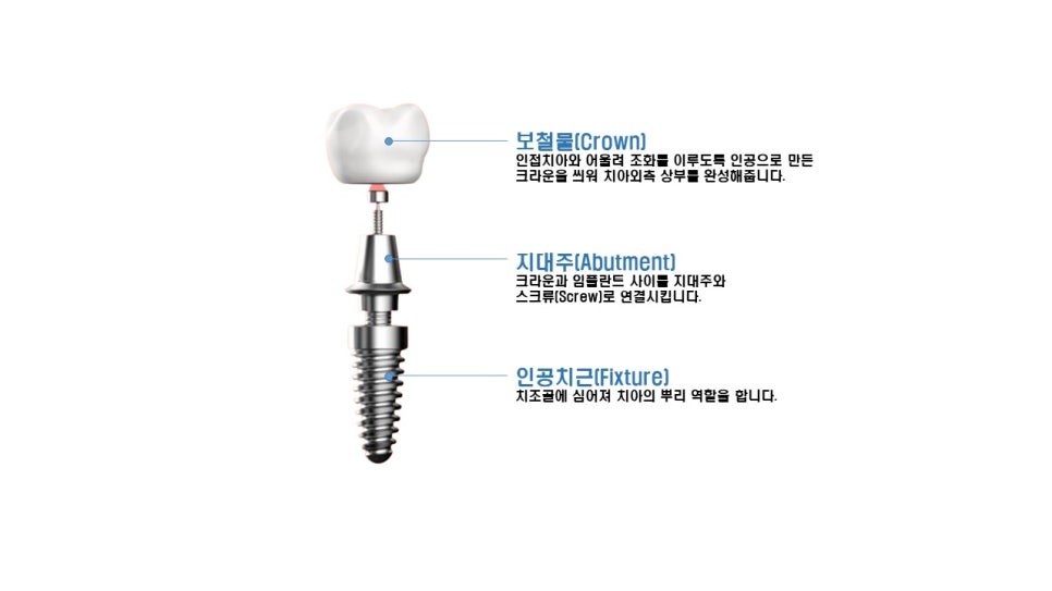 서울예봄치과 이미지