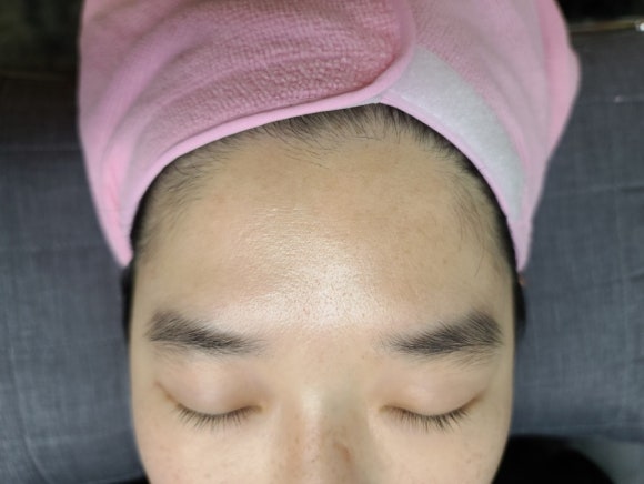썬헤어라인 이미지