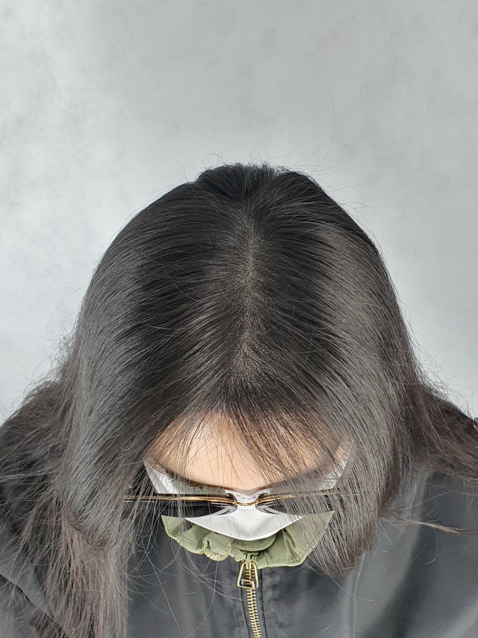 체인지헤어라인 이미지