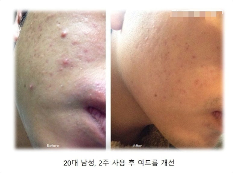올인원홈케어 이미지