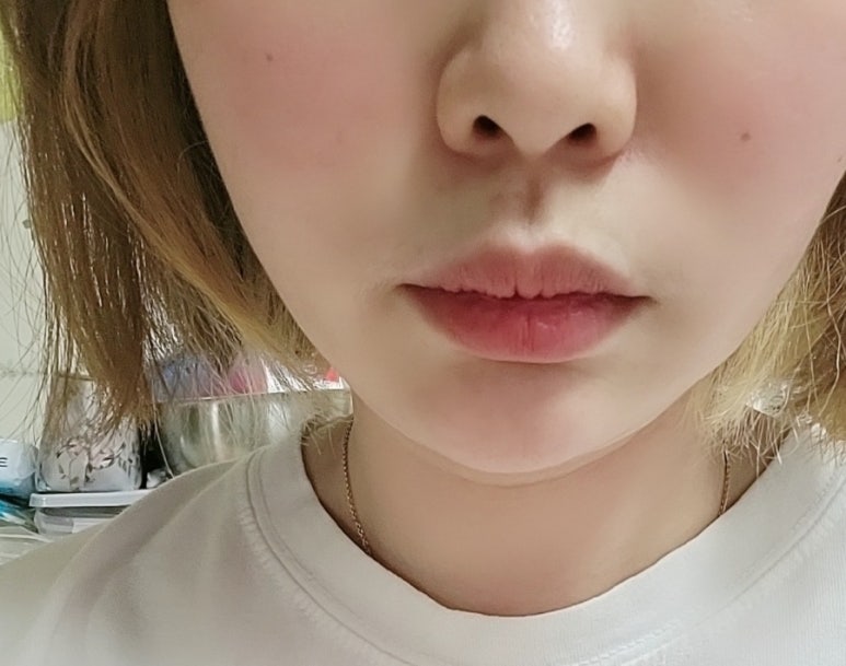 침산이튼튼치과 이미지