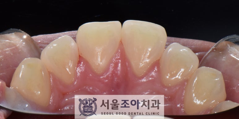 서울조아치과 이미지