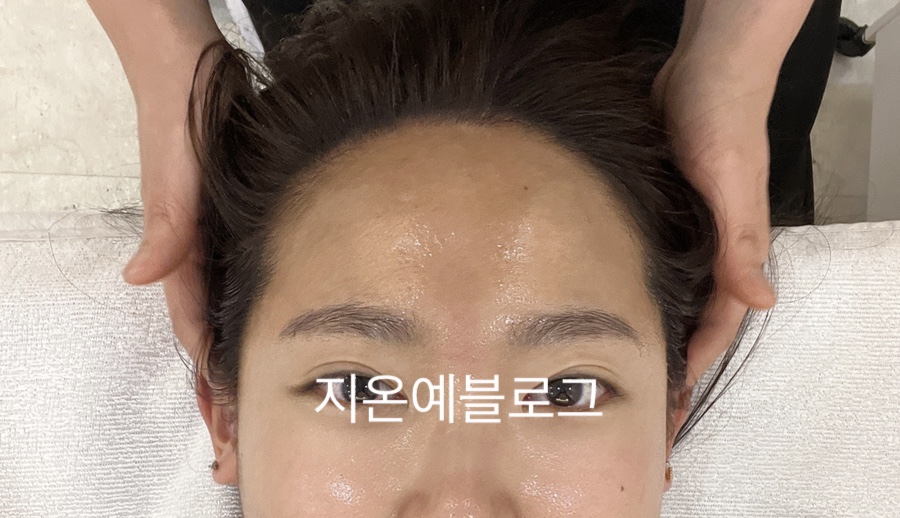 스킨 블레스 이미지