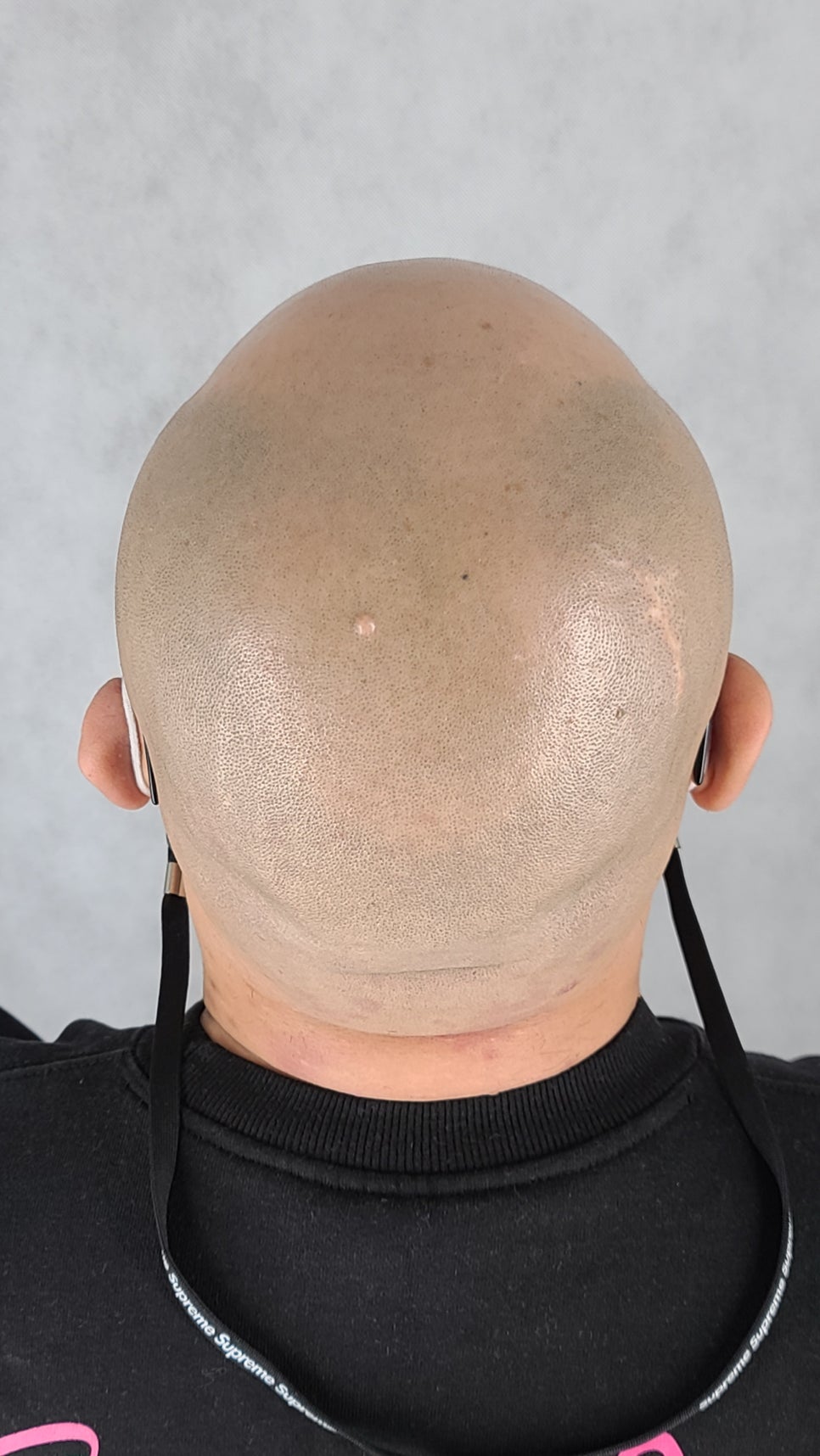 체인지유 이미지
