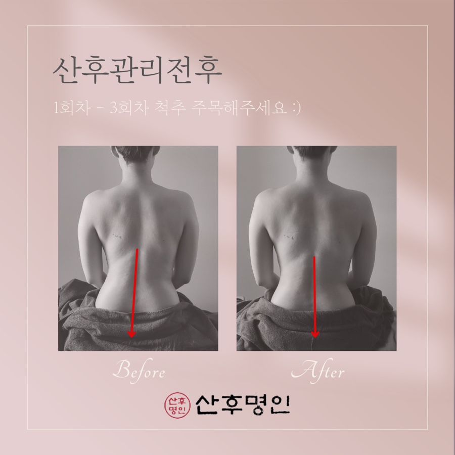 산후명인 이미지