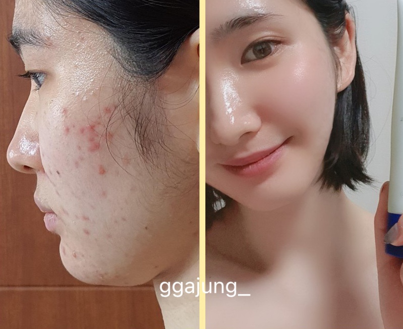 홈케어컨설팅 이미지