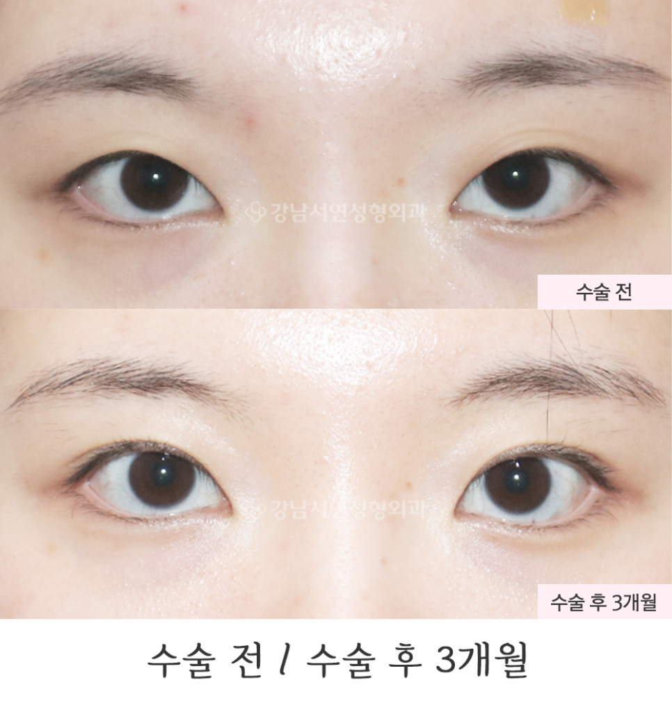 서연성형외과의원 이미지