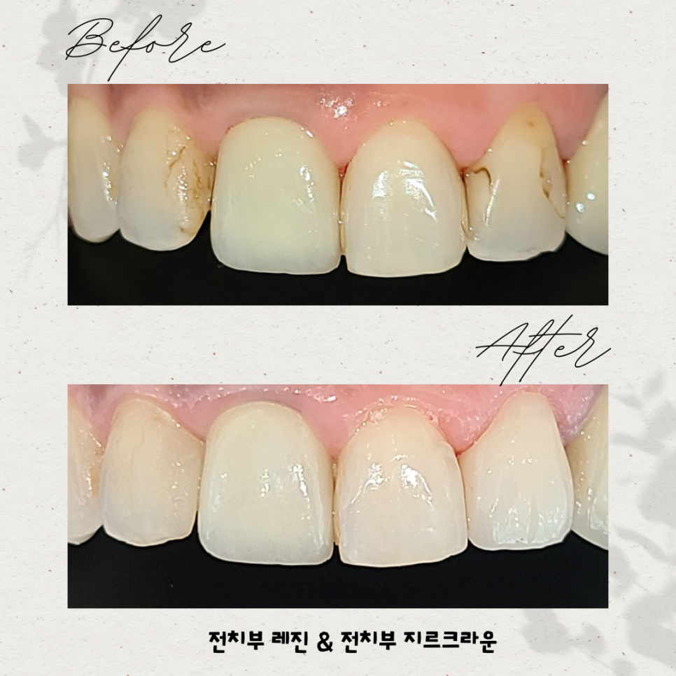 서울예봄치과 이미지