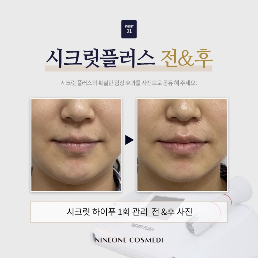 살롱에스 이미지