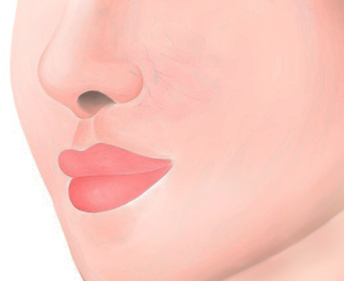 미소가인 이미지