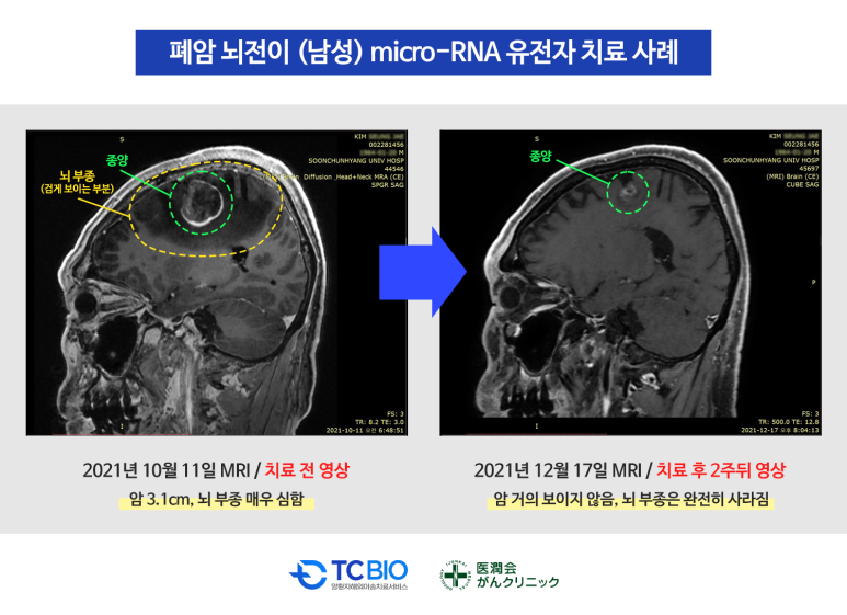 티시바이오 이미지