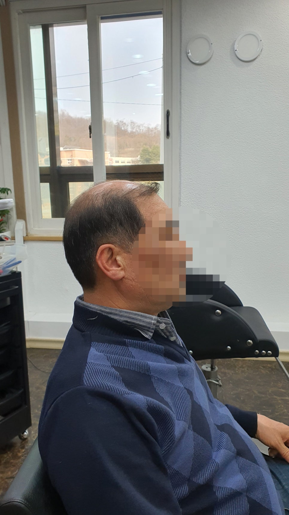 전주동안가발 이미지