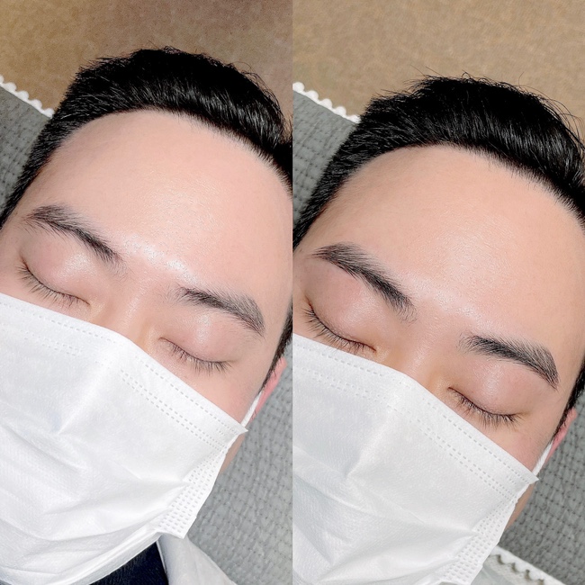 모숲 이미지