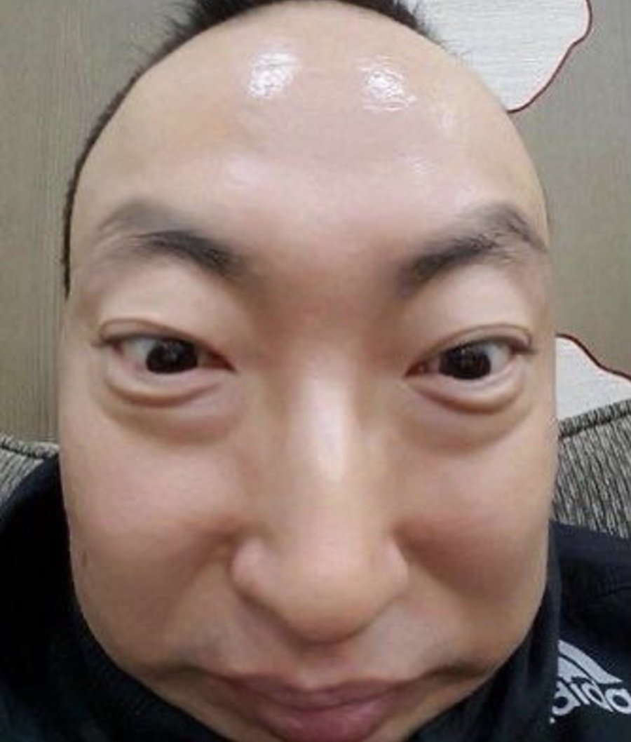 조짐 이미지