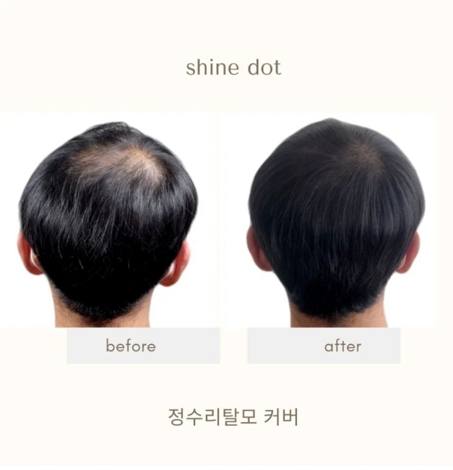 샤인도트 이미지