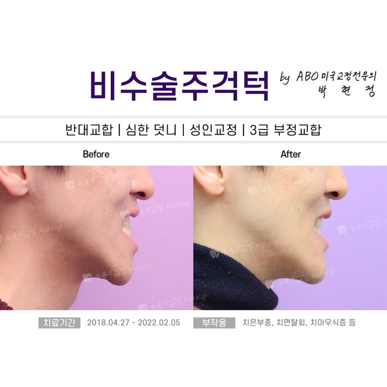 서면뉴욕치과의원 이미지