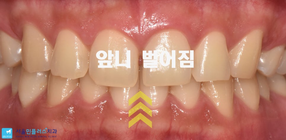 함박미소치과 이미지