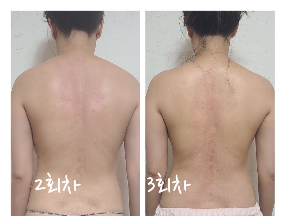 꼼꼼한테라피 이미지
