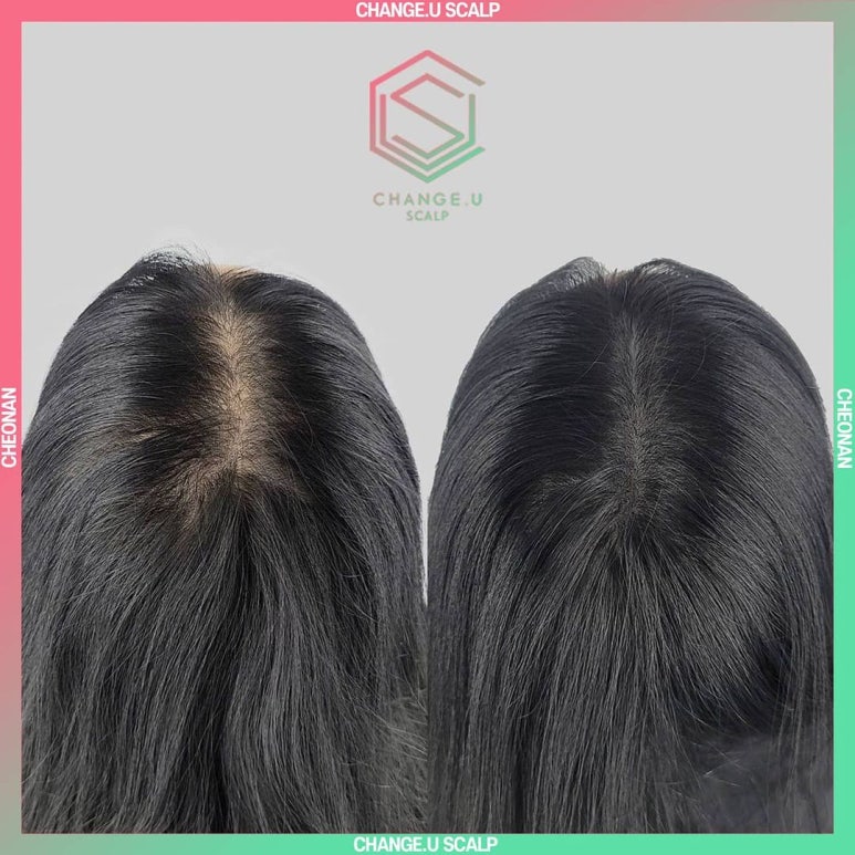 체인지유 이미지