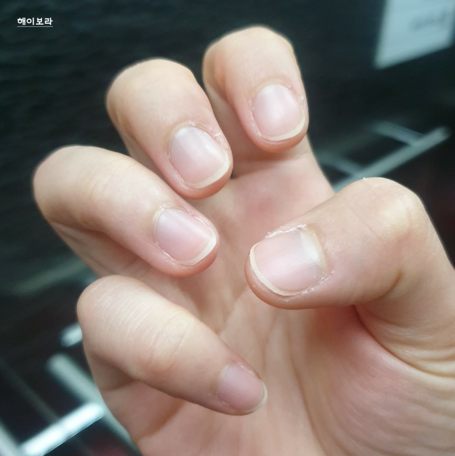 로네일 이미지