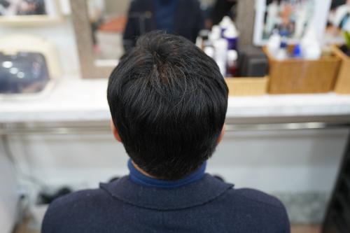 셀모가발 이미지
