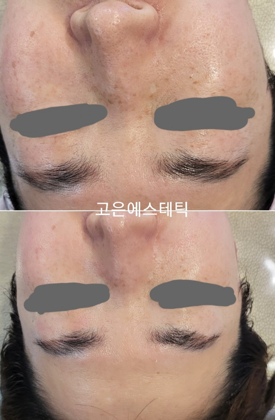 고은피부관리 이미지
