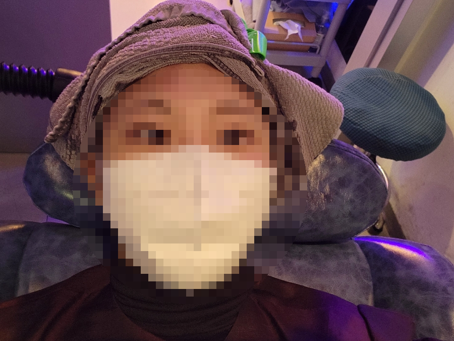 모바이오두피크리닉 이미지