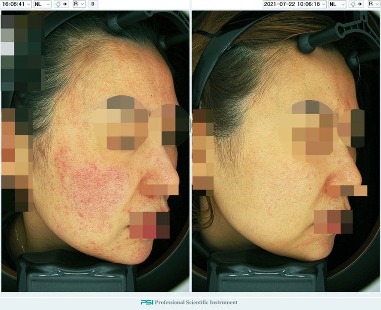 노바피부과의원 이미지