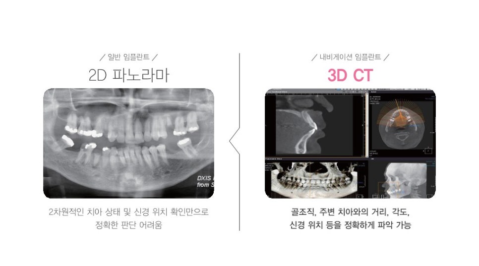 디오컴퓨터 이미지