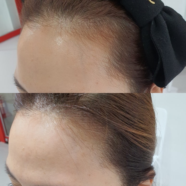 크리니시아오산 이미지
