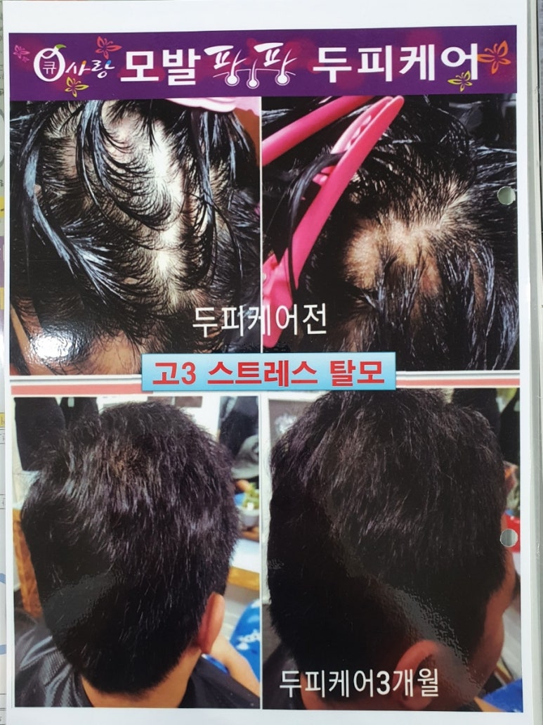 두피케어머리염색방 이미지