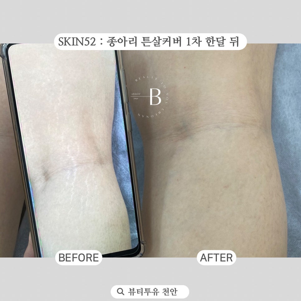 뷰티투유 이미지