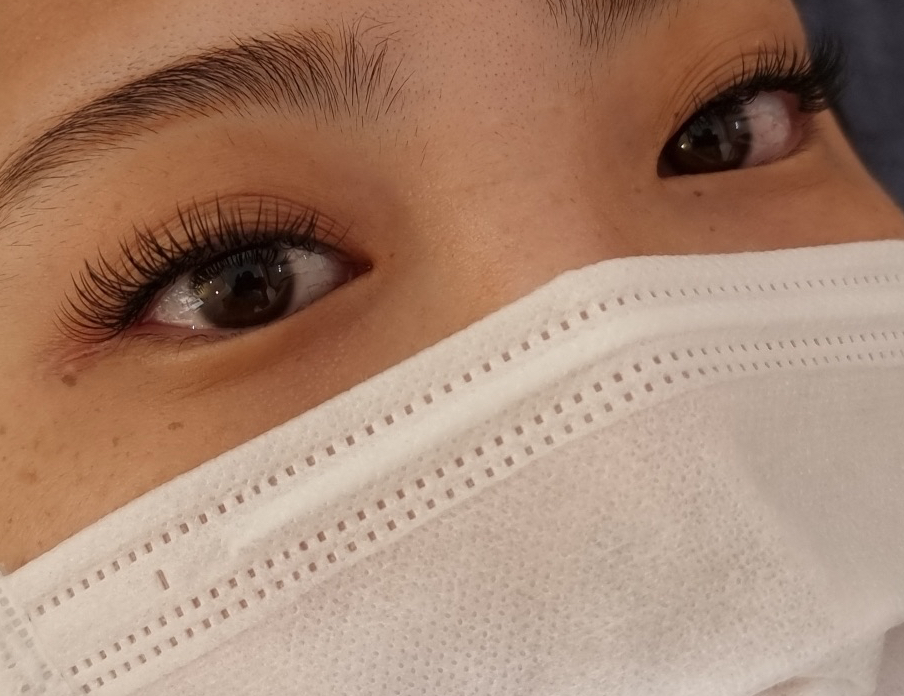 네일 더, 눈부심 이미지