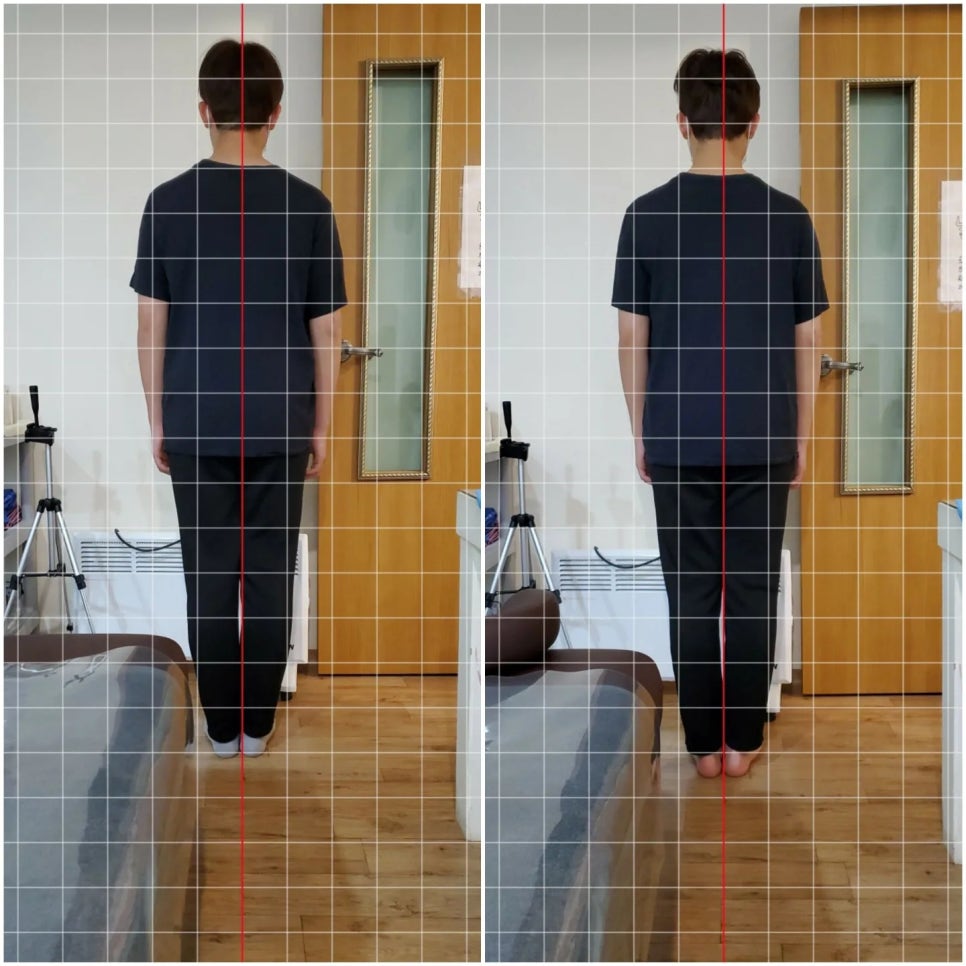 체형관리 이미지