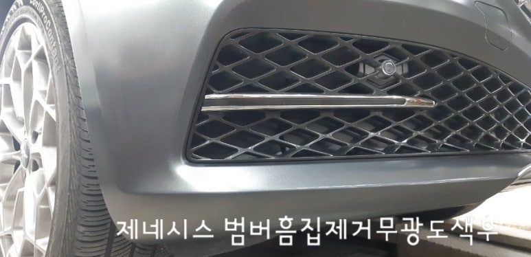 에이스덴트마스터 이미지