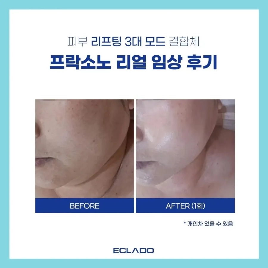 소노뷰티 이미지