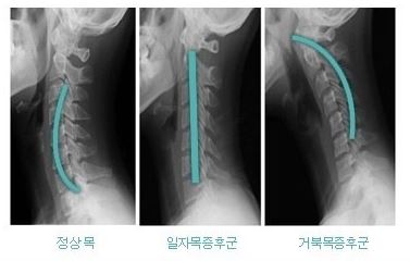 목담 이미지