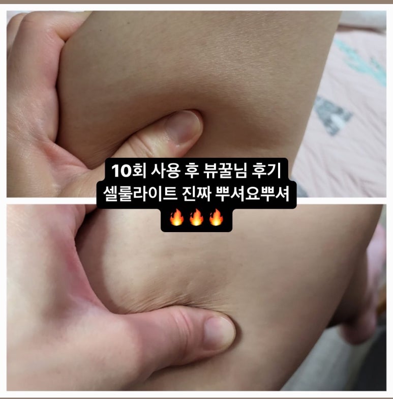 아셀홈케어 이미지