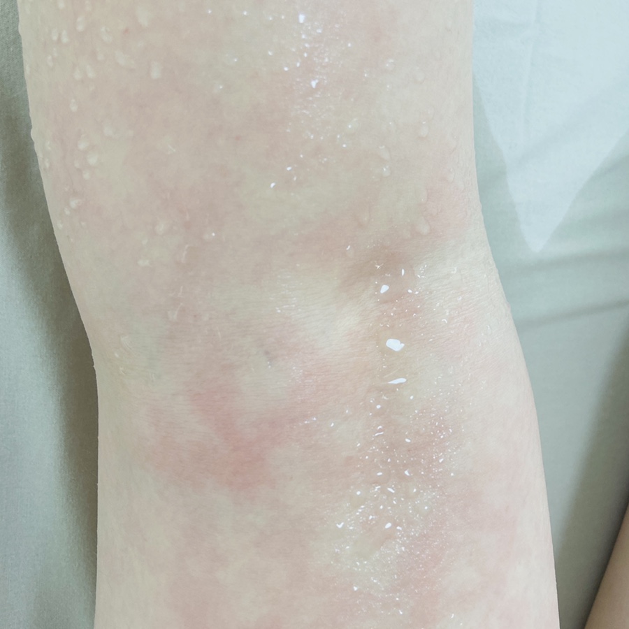 전신관리 이미지