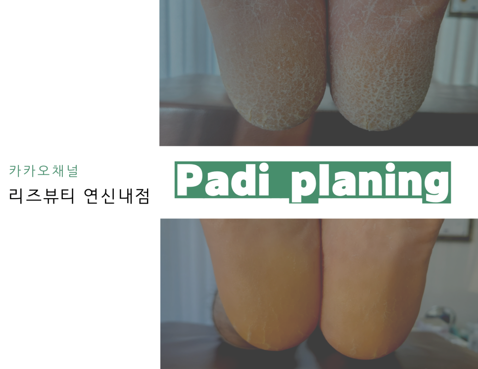 리즈뷰티 연신내점 이미지