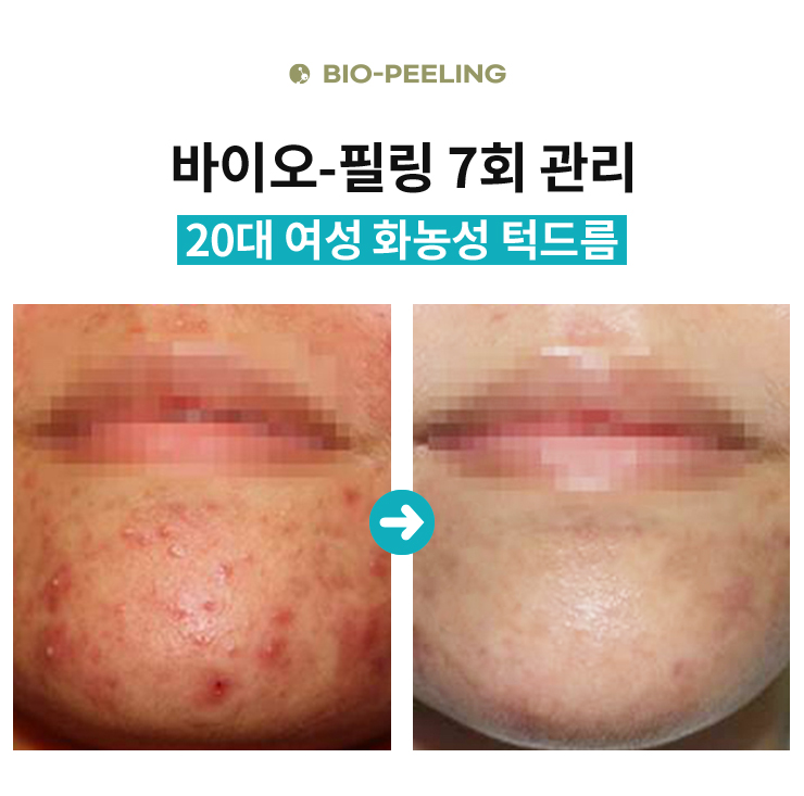 림에스테틱 이미지