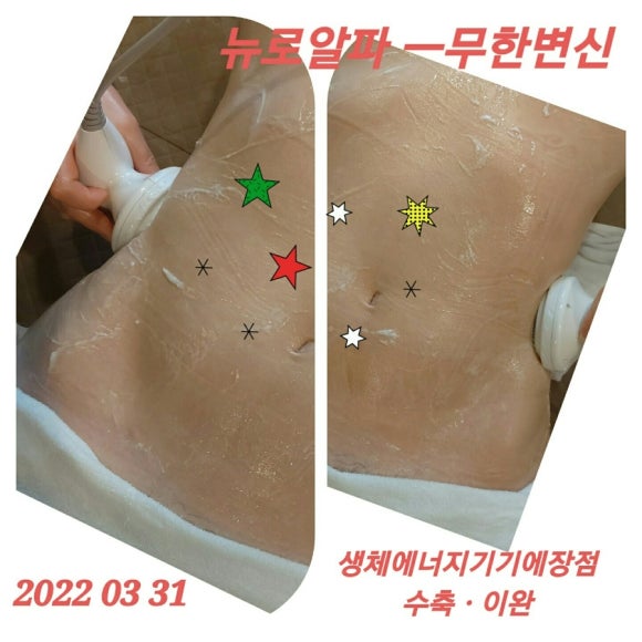 알파테라피 이미지