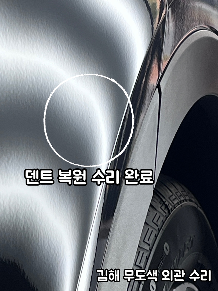 스피드덴트 이미지