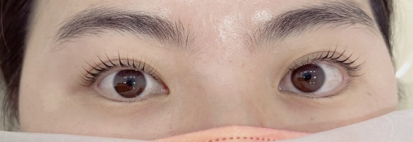 스마일데이지(Smile Daisy) 이미지