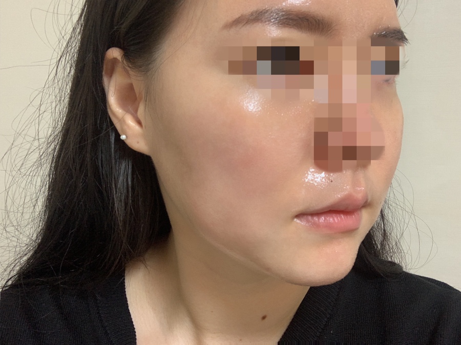 인셀덤 은평대리점 이미지